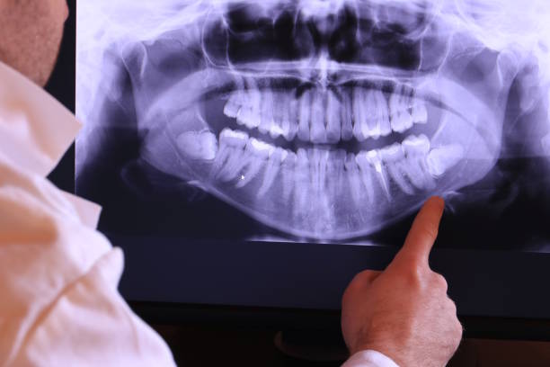 Best Orthodontic Emergency Dentist in Wyanet, IL