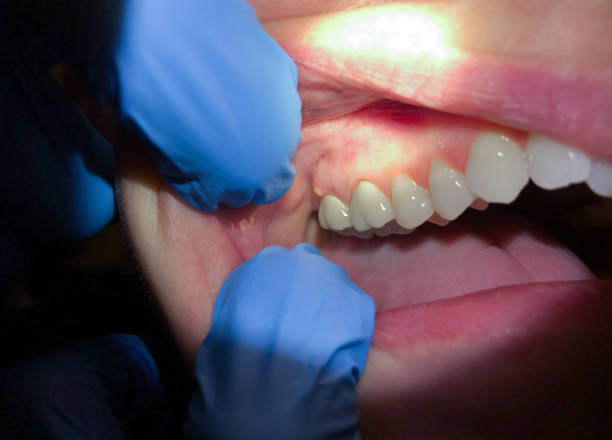 Best Pediatric Emergency Dentist in Wyanet, IL